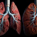 Malefícios do cigarro para a saúde: saiba por que parar pode salvar sua vida